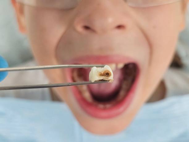 Best Emergency Cosmetic Dentistry (e.g., broken veneers) in Cana, VA